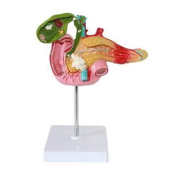 1:1 Gyvenimo dydis Kasos dvylikapirštės žarnos tulžies pūslės patologinis anatominis modelis Tulžies akmenų chirurginė virškinimo sistema blužnies modelis