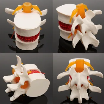 Žmogaus anatomija Skeletas Stuburo juosmens disko išvarža Mokymo modelis Smegenų kaukolės trauminis pistoletas Mokykla Reikmenys Medicinos instrume